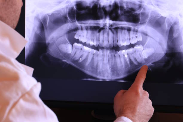 Best Dental Abscess Treatment in Belle Plaine, IA